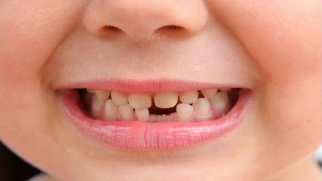 Chiêm bao thấy rụng răng đánh con gì để có lợi nhuận khủng?